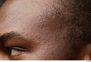 HD Face Skin Kavan face forehead skin pores skin texture…